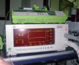 Monitorage des pressions intra-cardiaques et pulmonaires (photo : BAG 2003